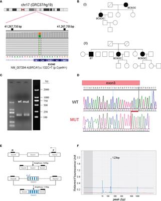 Characterization of Synonymous BRCA1:c.132C>T as a Pathogenic Variant